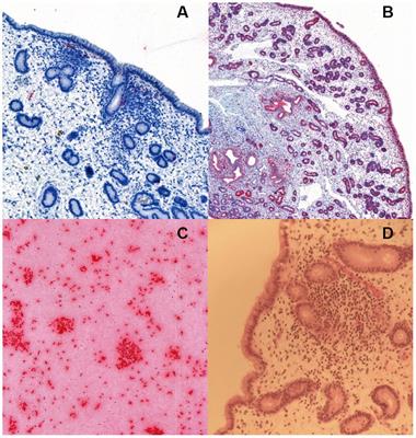 RNA in situ hybridization of Escherichia coli in equine endometrial biopsies